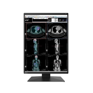 Monitor de Diagnóstico Radiforce RX370 Color