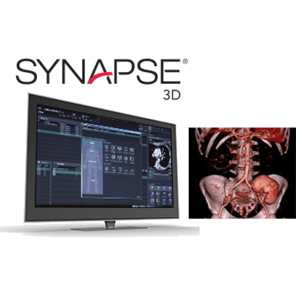 Synapse 3D - TIMED