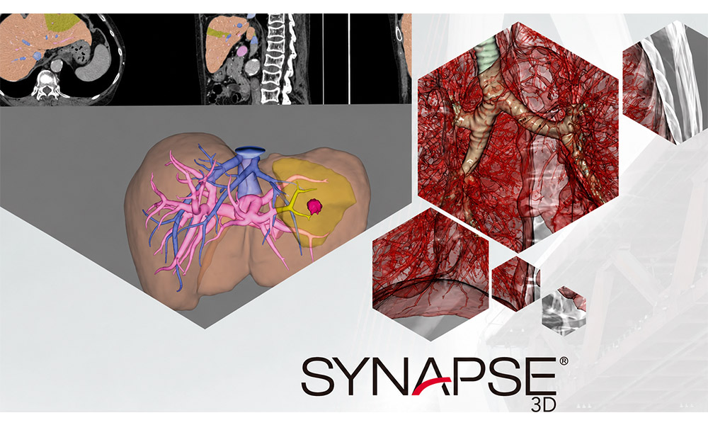 w_0002_Synapse 3D. (1)